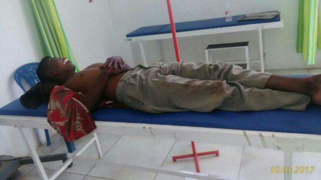 Warga Suku Anak Dalam (SAD) harus menjalani perawatan di Puskesmas Singkut.